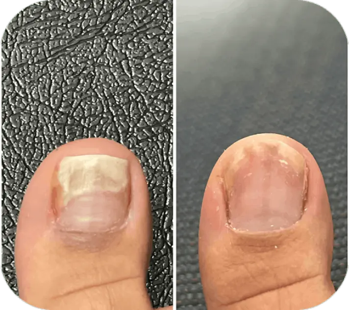 Funga beam customer review Bailey D.