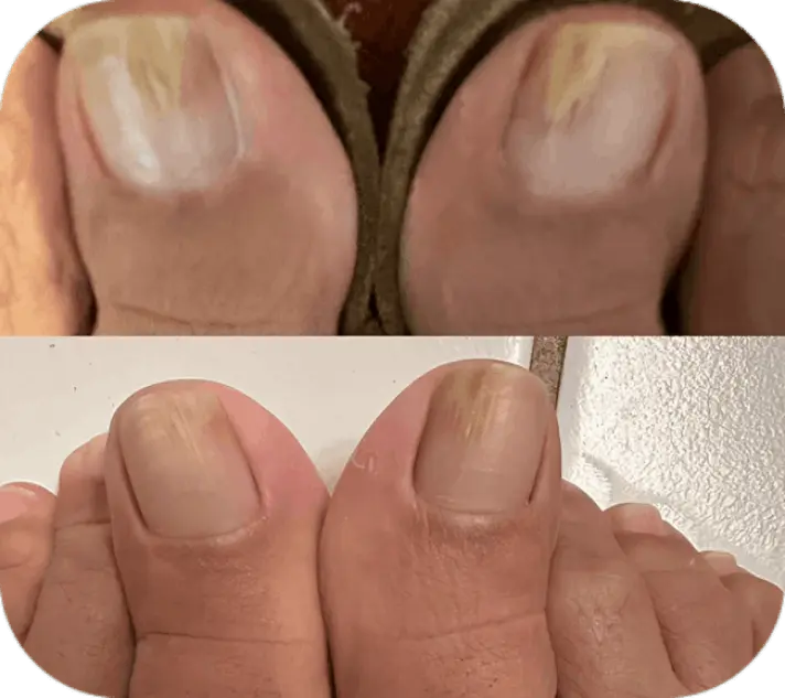 Funga beam customer review Terry L.