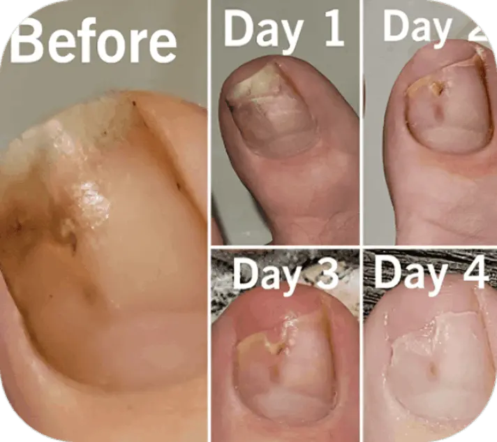 Funga beam review Drew A.